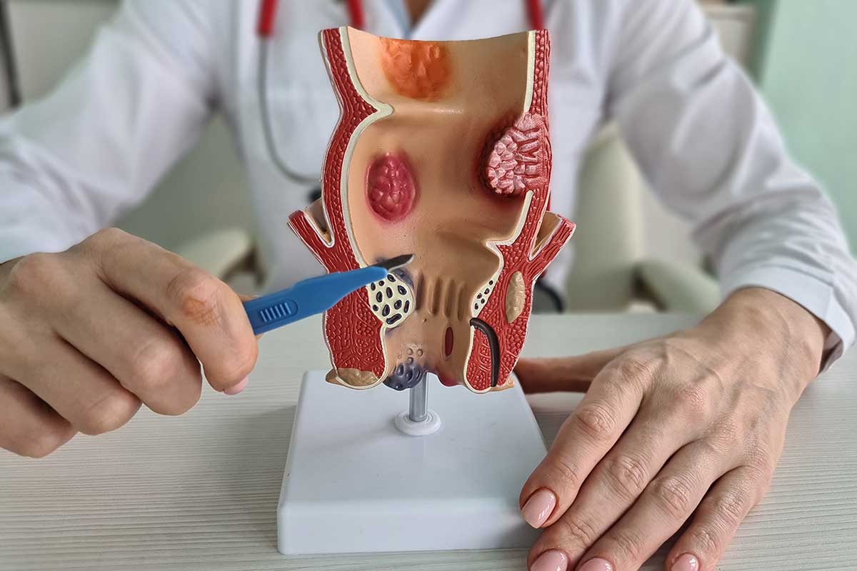 Proctologista em Paulínia / SP